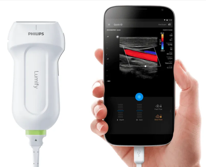 УЗИ-аппарат Philips Lumify